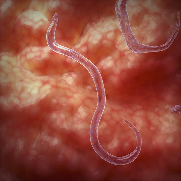 hookworms in humans images